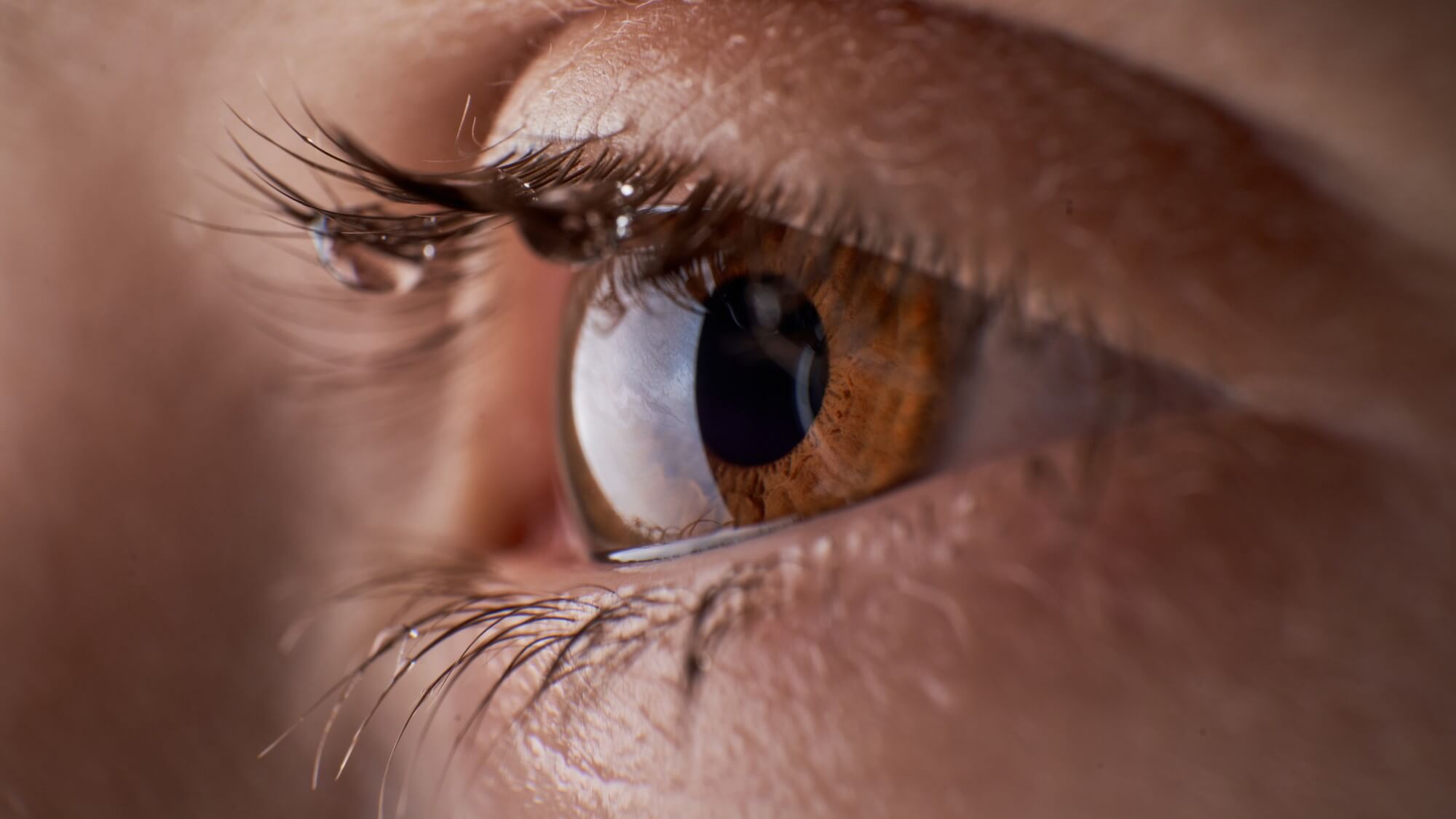 Battling Dry Eye Syndrome: A Comprehensive Guide to Home Remedies