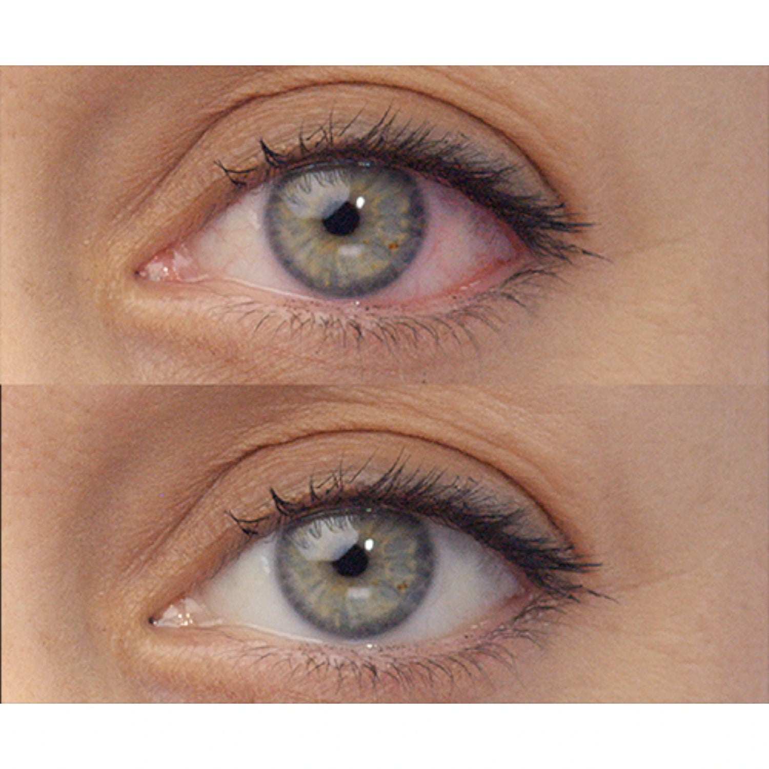 Gouttes oculaires antirougeur LUMIFY®