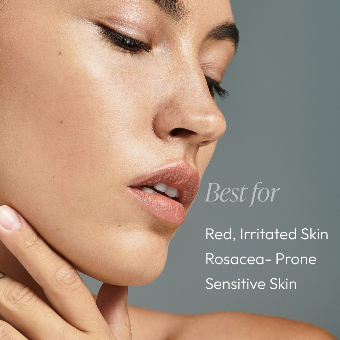 Rose-Ease Relief Cream 1.7oz