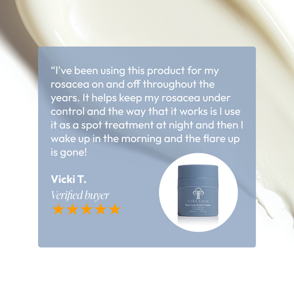 Rose-Ease Relief Cream 1.7oz